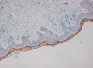 Immunohistochemistry (Formalin/PFA-fixed paraffin-embedded sections) - Anti-RNase 7 antibody [3C2] (AB189222)