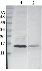 Western blot - Anti-RNase 7 antibody [3C2] (AB189222)