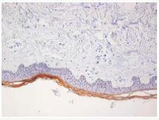 Immunohistochemistry (Formalin/PFA-fixed paraffin-embedded sections) - Anti-RNase 7 antibody [4C4] (AB205565)