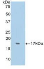 Western blot - Anti-RNase 7 antibody (AB233518), expandable thumbnail