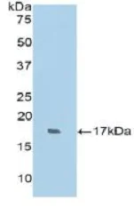 Western blot - Anti-RNase 7 antibody (AB233518)