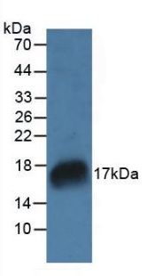 Western blot - Anti-RNase 7 antibody (AB233518), expandable thumbnail