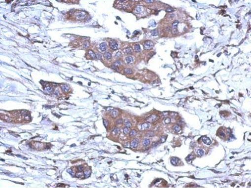 Immunohistochemistry (Formalin/PFA-fixed paraffin-embedded sections) - Anti-RNase H1/RNH1 antibody (AB229078)