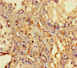 Immunohistochemistry (Formalin/PFA-fixed paraffin-embedded sections) - Anti-RNase L antibody (AB238159)
