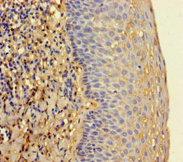 Immunohistochemistry (Formalin/PFA-fixed paraffin-embedded sections) - Anti-RNase L antibody (AB238159)