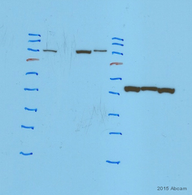 Western blot - Anti-RNase L antibody [EPR15894] (AB191392)