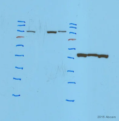 Western blot - Anti-RNase L antibody [EPR15894] (AB191392)