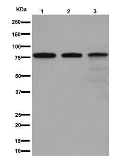 Western blot - Anti-RNase L antibody [EPR15894] (AB191392)