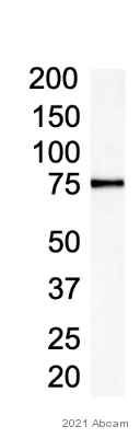 Western blot - Anti-RNase L antibody [EPR15894] (AB191392)