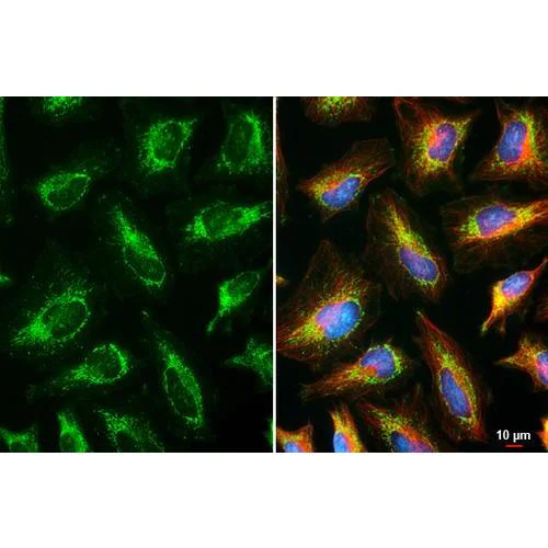 Immunocytochemistry/ Immunofluorescence - Anti-RNase L antibody [HL2340] (AB317201)