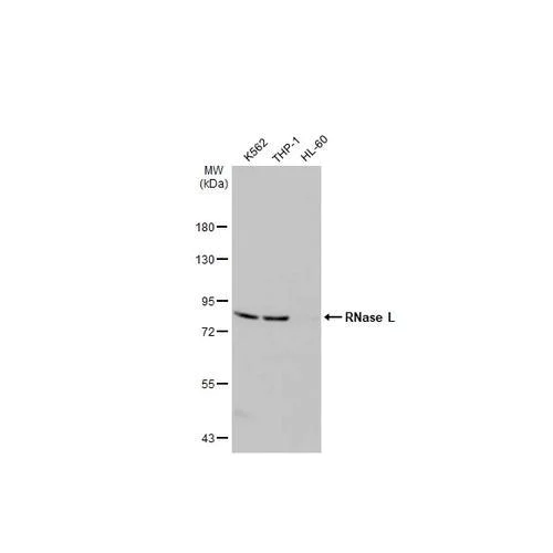 Western blot - Anti-RNase L antibody [HL2340] (AB317201)