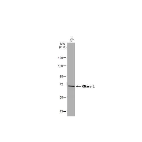 Western blot - Anti-RNase L antibody [HL2341] (AB317202)