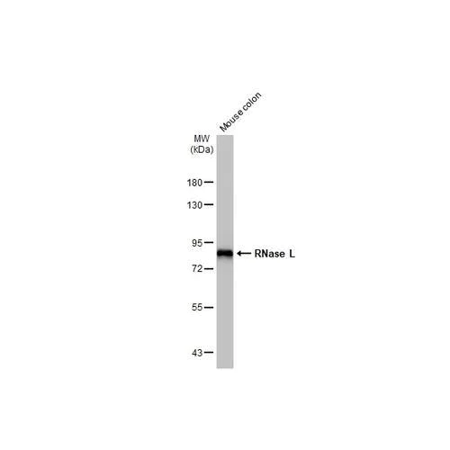 Western blot - Anti-RNase L antibody [HL2341] (AB317202)