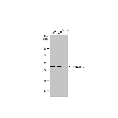 Western blot - Anti-RNase L antibody [HL2341] (AB317202)