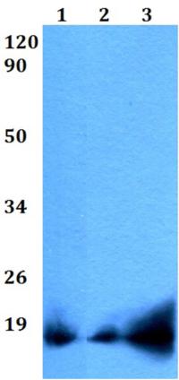 Western blot - Anti-RNASE4 antibody (AB200717)