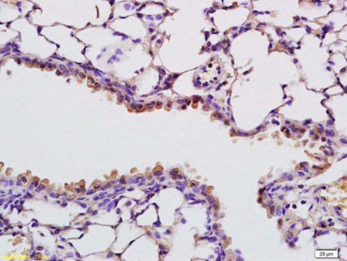 Immunohistochemistry (Formalin/PFA-fixed paraffin-embedded sections) - Anti-RNASE4 antibody (AB214293)