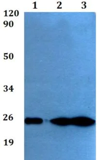 Western blot - Anti-RND2 antibody (AB200713)
