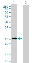 Western blot - Anti-RND3 antibody (AB171799)