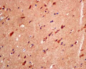 Immunohistochemistry (Formalin/PFA-fixed paraffin-embedded sections) - Anti-RNF11 antibody [EPR6820] (AB154831)