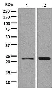 Western blot - Anti-RNF11 antibody [EPR6820] (AB154831)