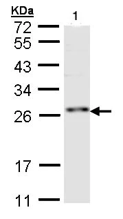 Western blot - Anti-RNF114 antibody (AB97303)