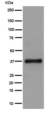 Western blot - Anti-RNF115 antibody [EPR14539] (AB187642)