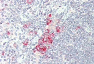 Immunohistochemistry (Formalin/PFA-fixed paraffin-embedded sections) - Anti-RNF125 antibody (AB211450)
