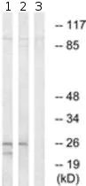Western blot - Anti-RNF125 antibody (AB211450)