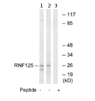Western blot - Anti-RNF125 antibody (AB74373)
