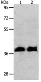Western blot - Anti-RNF126 antibody (AB183102)
