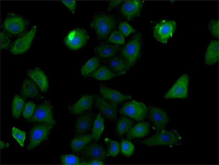 Immunocytochemistry/ Immunofluorescence - Anti-RNF126 antibody (AB234812)