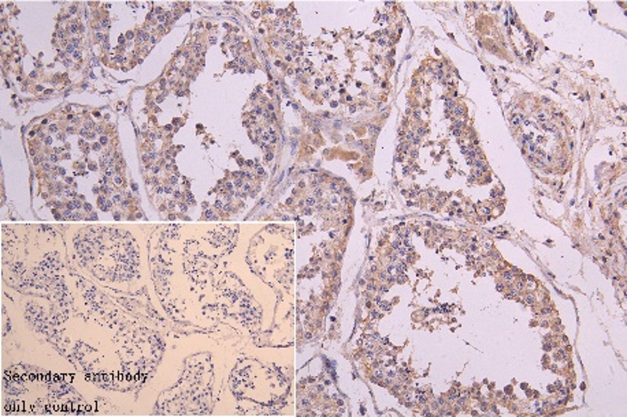 Immunohistochemistry (Formalin/PFA-fixed paraffin-embedded sections) - Anti-RNF126 antibody (AB234812), expandable thumbnail