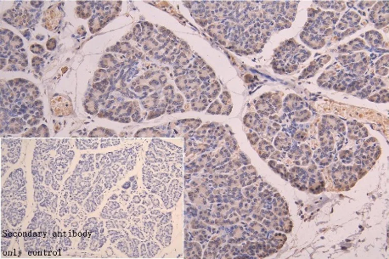 Immunohistochemistry (Formalin/PFA-fixed paraffin-embedded sections) - Anti-RNF126 antibody (AB234812)