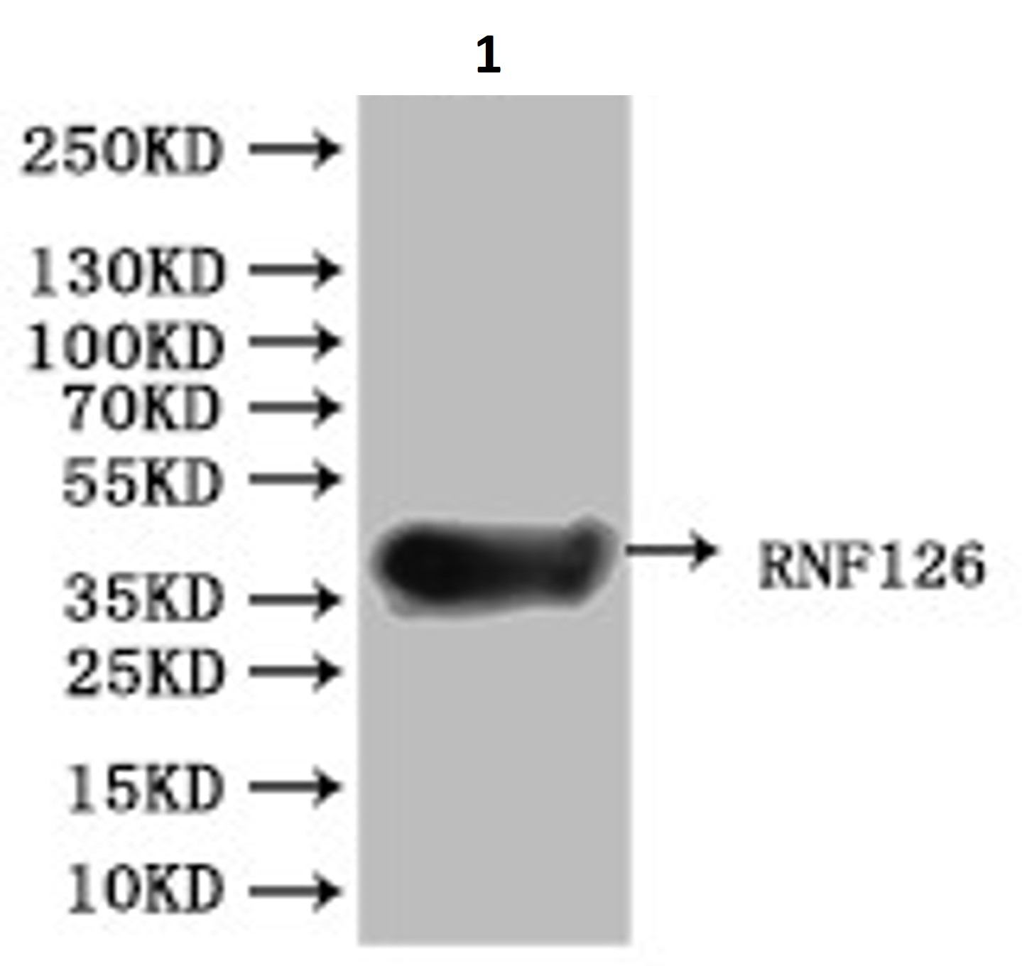 Western blot - Anti-RNF126 antibody (AB234812), expandable thumbnail