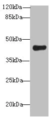 Western blot - Anti-RNF128/GRAIL antibody (AB237684)