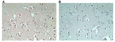 Immunohistochemistry (Formalin/PFA-fixed paraffin-embedded sections) - Anti-RNF128/GRAIL antibody (AB72533)