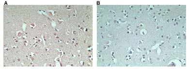 Immunohistochemistry (Formalin/PFA-fixed paraffin-embedded sections) - Anti-RNF128/GRAIL antibody (AB72533)