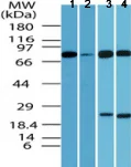 Western blot - Anti-RNF128/GRAIL antibody (AB72533)