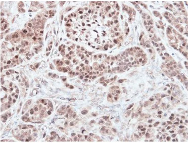 Immunohistochemistry (Formalin/PFA-fixed paraffin-embedded sections) - Anti-RNF13 antibody - C-terminal (AB151601)