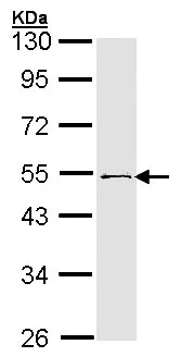 Western blot - Anti-RNF13 antibody - C-terminal (AB151601)