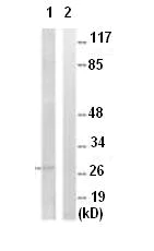 Western blot - Anti-RNF138/HSD-4 antibody (AB92730)