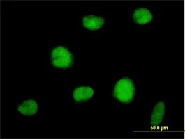 Immunocytochemistry/ Immunofluorescence - Anti-RNF144A antibody (AB89260)