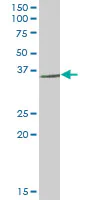 Western blot - Anti-RNF144A antibody (AB89260)
