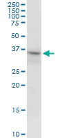 Western blot - Anti-RNF144A antibody (AB89260)
