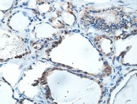 Immunohistochemistry (Formalin/PFA-fixed paraffin-embedded sections) - Anti-RNF146 antibody (AB201212)