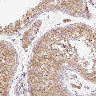 Immunohistochemistry (Formalin/PFA-fixed paraffin-embedded sections) - Anti-RNF167 antibody (AB185099)
