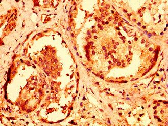 Immunohistochemistry (Formalin/PFA-fixed paraffin-embedded sections) - Anti-RNF168 antibody (AB235892)