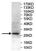 Western blot - Anti-RNF183 antibody (AB197321)