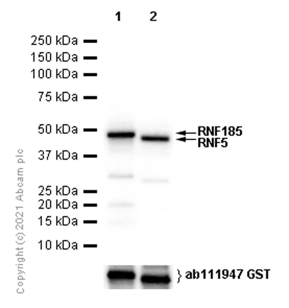 Western blot - Anti-RNF185 + RNF5/NG2 antibody [EPR14070-94] (AB181999)