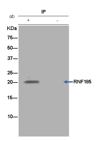 Immunoprecipitation - Anti-RNF185 + RNF5/NG2 antibody [EPR14070-94] - BSA and Azide free (AB250564)